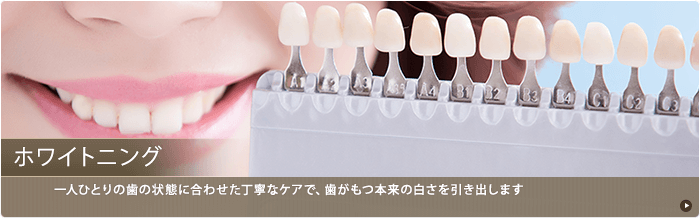 ホワイトニング