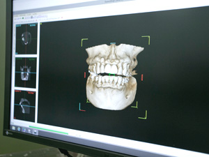 歯科用CTドック